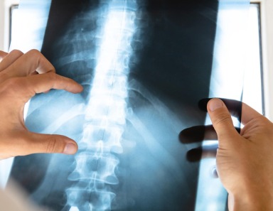 spinal injury; no win, no fee; medical negligence; accident; personal injury; free advice; injury solicitors